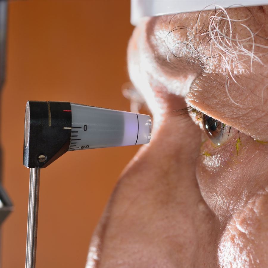 CIRURGIA PARA CORREÇÃO DE GLAUCOMA